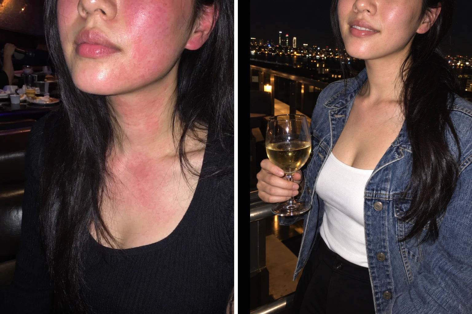 Illustration: a woman in a black top with red cheeks, neck and chest on the left, and the same woman in a denim jacket with far less red on the right