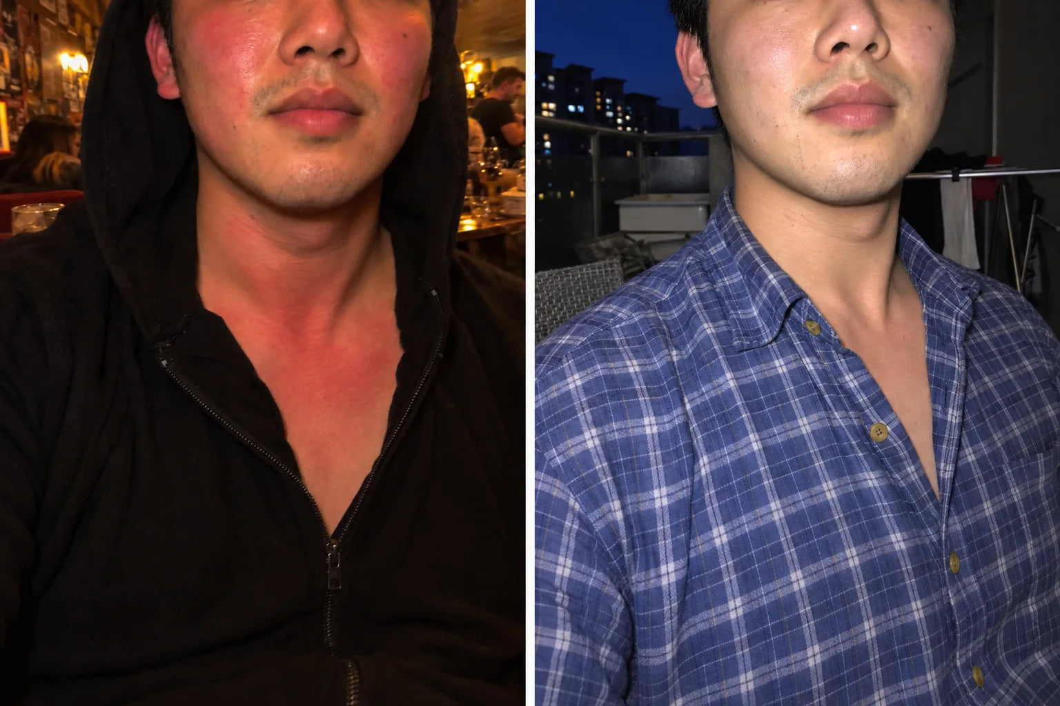 Illustration: a man in a black hoodie with a red face, neck and chest on the left, and the same man in a blue checked shirt with far less red on the right