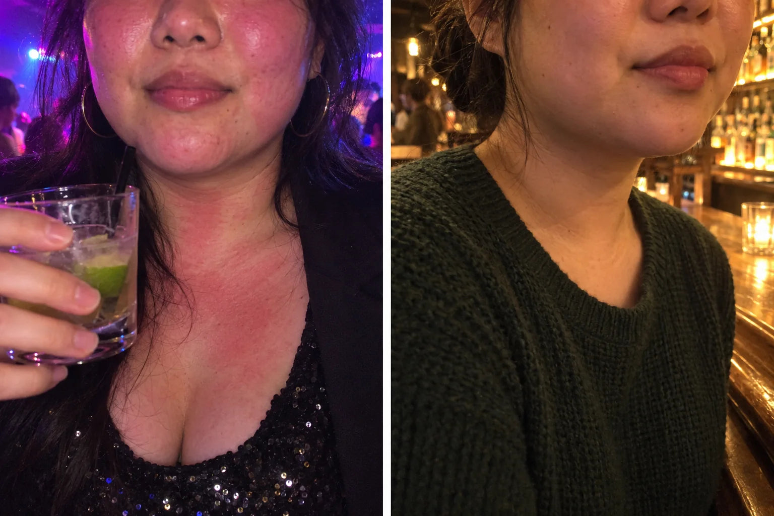 A flushed face and neck on the left, the same person with only a faint pink on the right